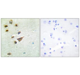 Immunohistochemistry - Anti-NT5C3 Antibody (C11674) - Antibodies.com