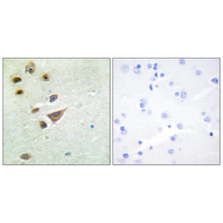 Immunohistochemistry - Anti-NT5C3 Antibody (C11674) - Antibodies.com