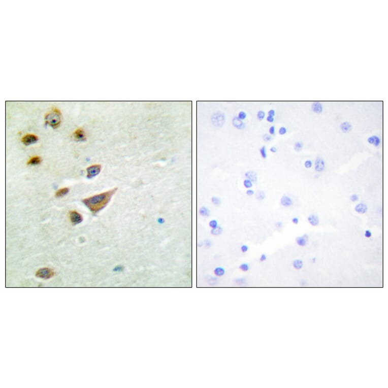 Immunohistochemistry - Anti-NT5C3 Antibody (C11674) - Antibodies.com