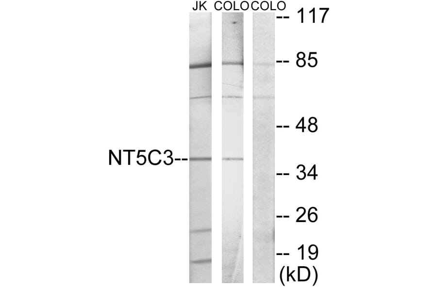 Western Blot - Anti-NT5C3 Antibody (C11674) - Antibodies.com