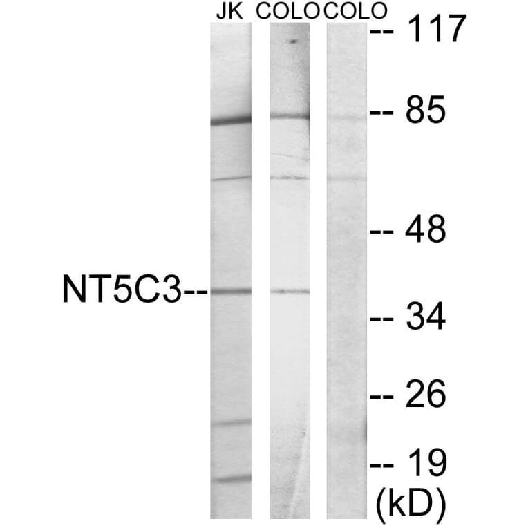 Western Blot - Anti-NT5C3 Antibody (C11674) - Antibodies.com