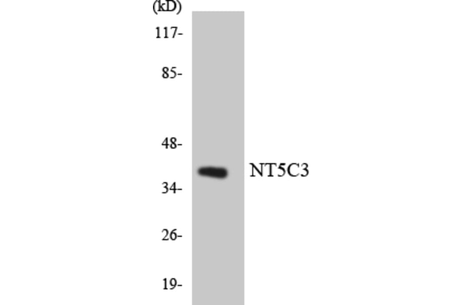 Western Blot - Anti-NT5C3 Antibody (R12-3111) - Antibodies.com