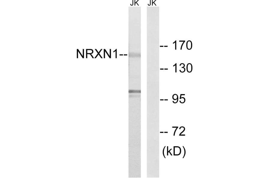 Western Blot - Anti-NRXN1 Antibody (C16909) - Antibodies.com
