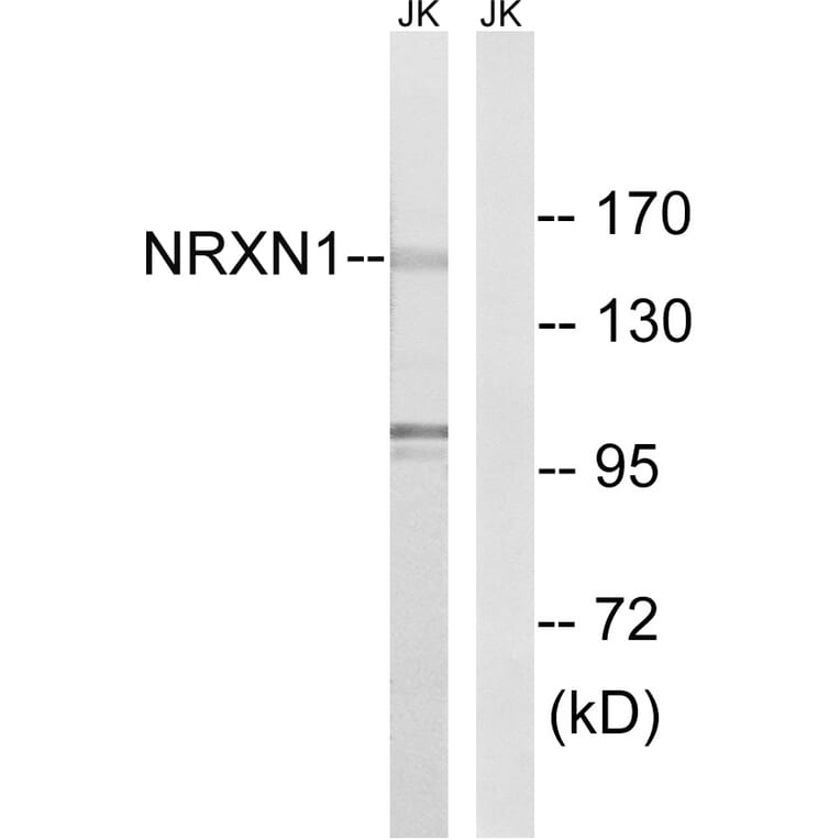 Western Blot - Anti-NRXN1 Antibody (C16909) - Antibodies.com
