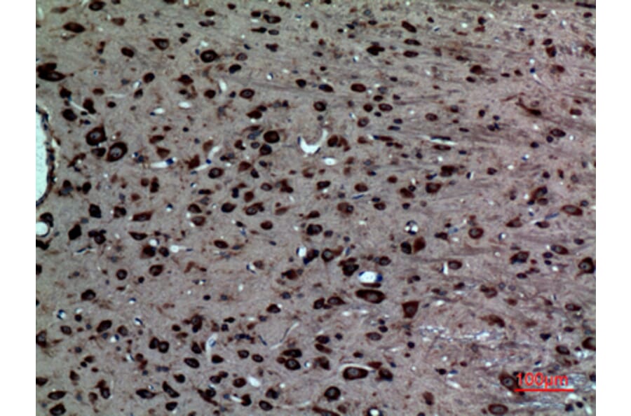 Immunohistochemistry - Anti-NR1H3 Antibody (C30010) - Antibodies.com