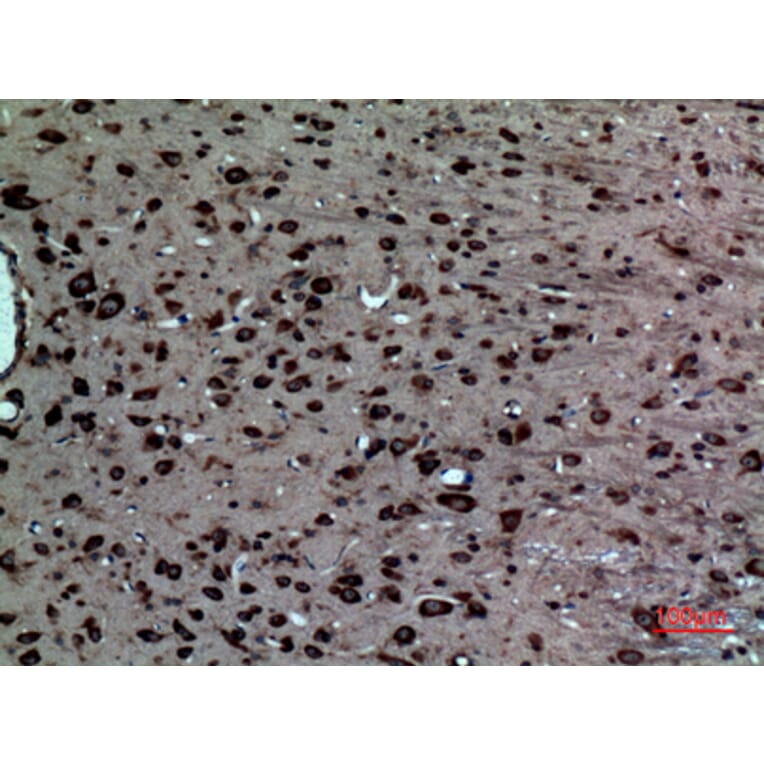 Immunohistochemistry - Anti-NR1H3 Antibody (C30010) - Antibodies.com