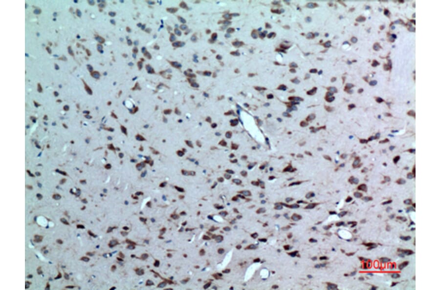 Immunohistochemistry - Anti-NR1H3 Antibody (C30010) - Antibodies.com