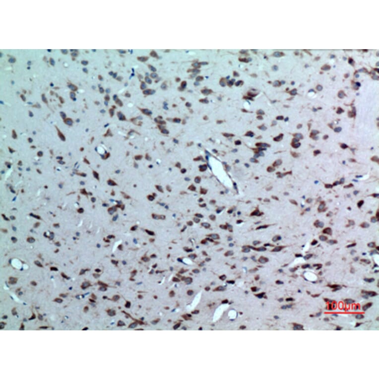 Immunohistochemistry - Anti-NR1H3 Antibody (C30010) - Antibodies.com