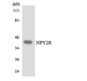 Western Blot - Anti-NPY2R Antibody (R12-3103) - Antibodies.com