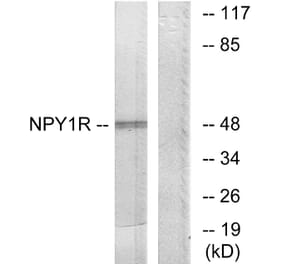 Western Blot - Anti-NPY1R Antibody (G409) - Antibodies.com