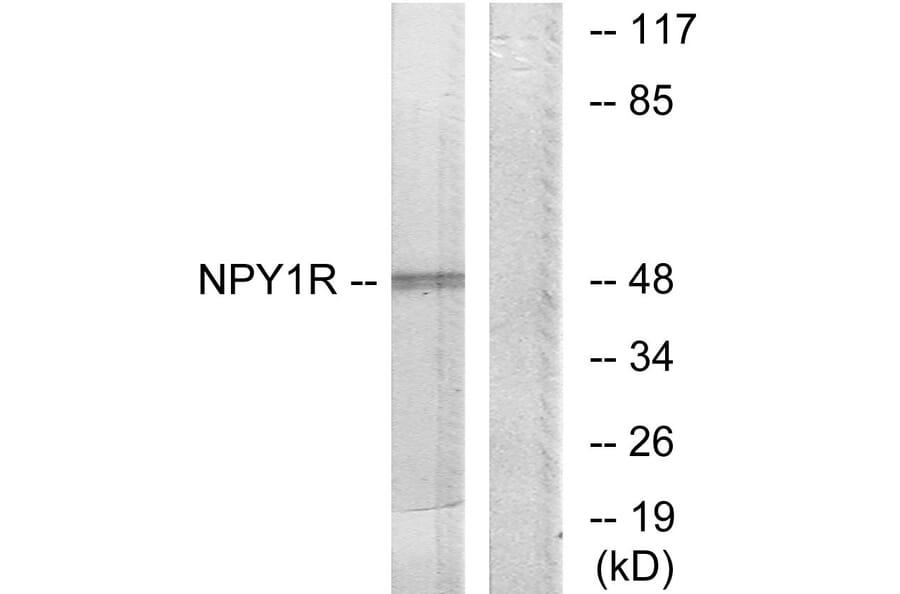 Western Blot - Anti-NPY1R Antibody (G409) - Antibodies.com