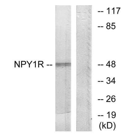 Western Blot - Anti-NPY1R Antibody (G409) - Antibodies.com