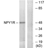 Western Blot - Anti-NPY1R Antibody (G409) - Antibodies.com