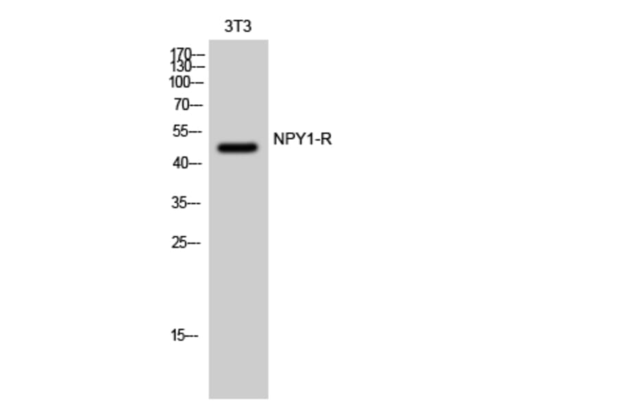 Western Blot - Anti-NPY1R Antibody (G409) - Antibodies.com