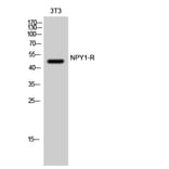 Western Blot - Anti-NPY1R Antibody (G409) - Antibodies.com