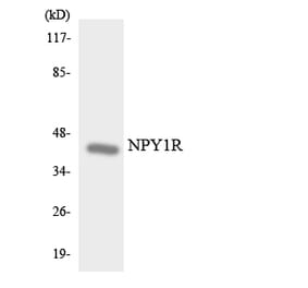 Western Blot - Anti-NPY1R Antibody (R12-3102) - Antibodies.com