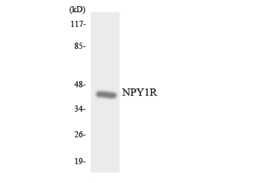 Western Blot - Anti-NPY1R Antibody (R12-3102) - Antibodies.com