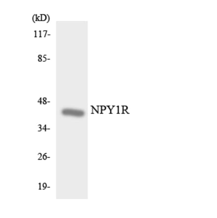 Western Blot - Anti-NPY1R Antibody (R12-3102) - Antibodies.com