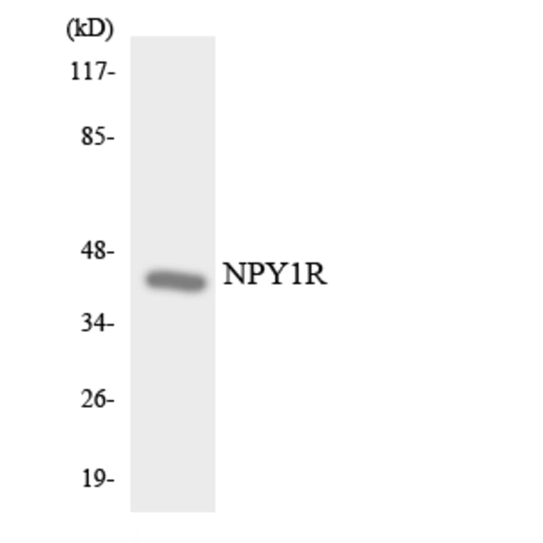 Western Blot - Anti-NPY1R Antibody (R12-3102) - Antibodies.com