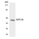 Western Blot - Anti-NPY1R Antibody (R12-3102) - Antibodies.com