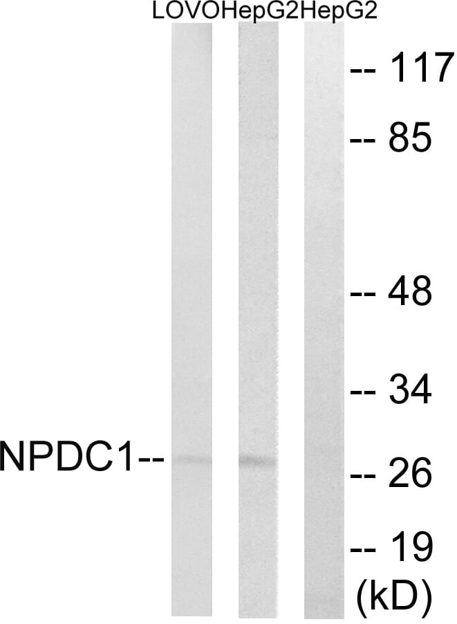 Western blot analysis of lysates from HepG2 and LOVO cells using Anti-NPDC1 Antibody. The right hand lane represents a negative control, where the antibody is blocked by the immunising peptide.