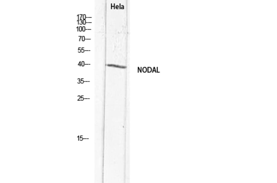 Western Blot - Anti-NODAL Antibody (C30708) - Antibodies.com