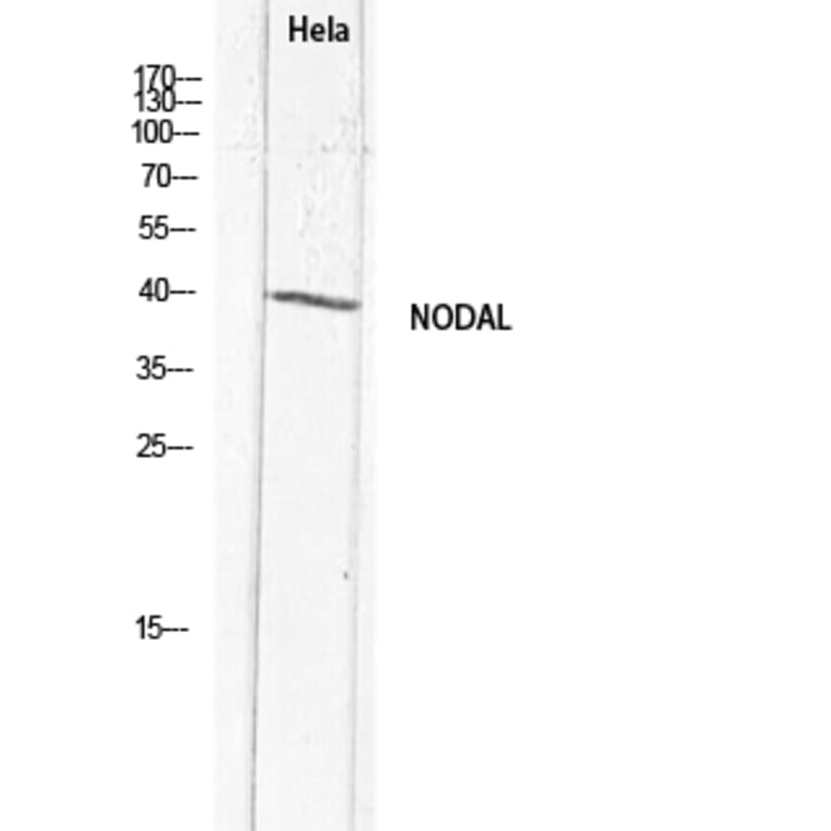 Western Blot - Anti-NODAL Antibody (C30708) - Antibodies.com