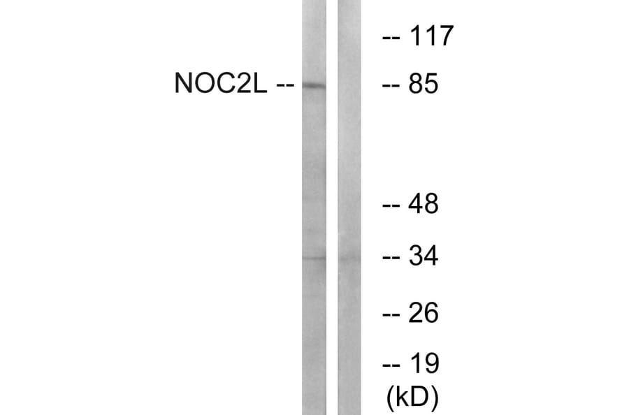 Western Blot - Anti-NOC2L Antibody (C17146) - Antibodies.com