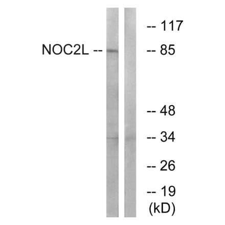 Western Blot - Anti-NOC2L Antibody (C17146) - Antibodies.com