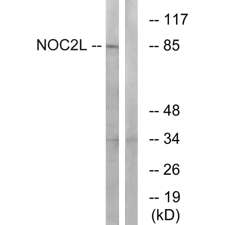 Western Blot - Anti-NOC2L Antibody (C17146) - Antibodies.com