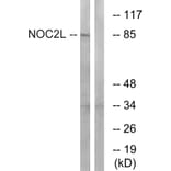 Western Blot - Anti-NOC2L Antibody (C17146) - Antibodies.com