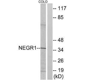 Western Blot - Anti-NEGR1 Antibody (C16994) - Antibodies.com