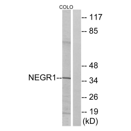 Western Blot - Anti-NEGR1 Antibody (C16994) - Antibodies.com