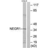 Western Blot - Anti-NEGR1 Antibody (C16994) - Antibodies.com