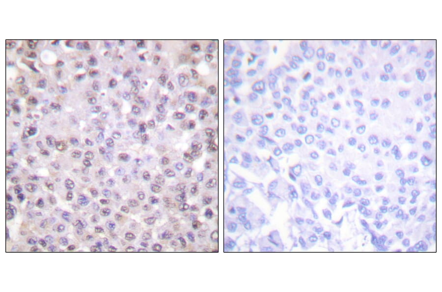 Immunohistochemistry - Anti-NCoR1 Antibody (C0358) - Antibodies.com