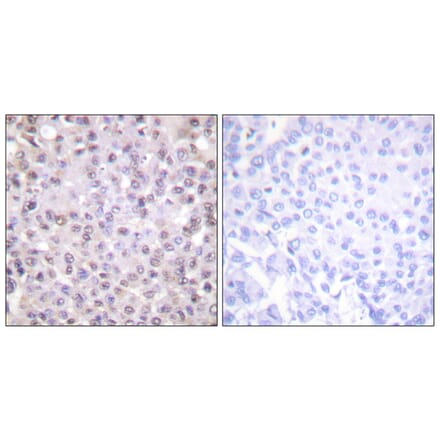 Immunohistochemistry - Anti-NCoR1 Antibody (C0358) - Antibodies.com