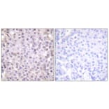 Immunohistochemistry - Anti-NCoR1 Antibody (C0358) - Antibodies.com
