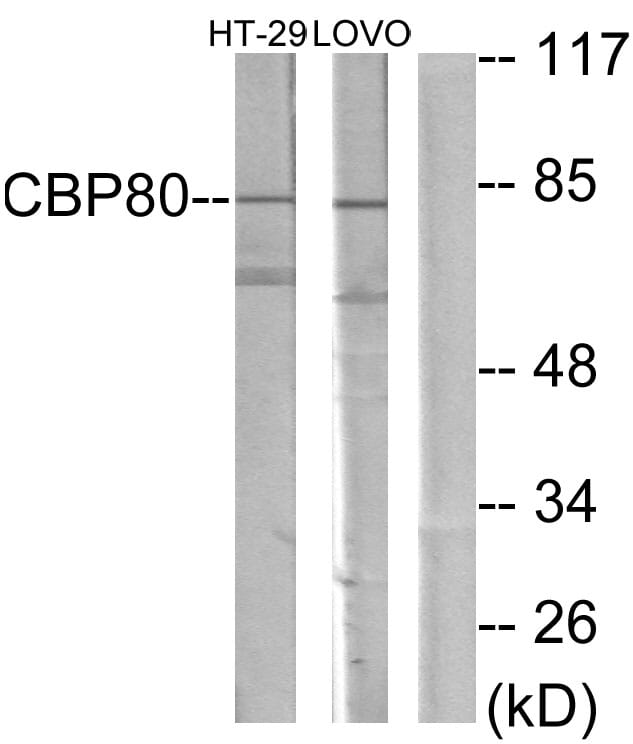 Western blot analysis of lysates from HT-29 and LOVO cells using Anti-NCBP1 Antibody. The right hand lane represents a negative control, where the antibody is blocked by the immunising peptide.