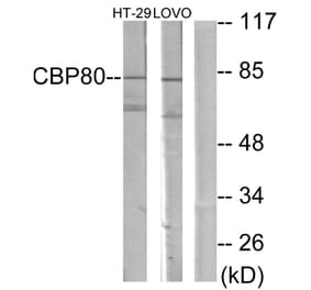 Western Blot - Anti-NCBP1 Antibody (C10911) - Antibodies.com