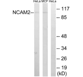 Western Blot - Anti-NCAM2 Antibody (C16899) - Antibodies.com