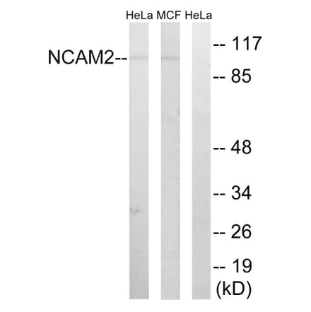 Western Blot - Anti-NCAM2 Antibody (C16899) - Antibodies.com