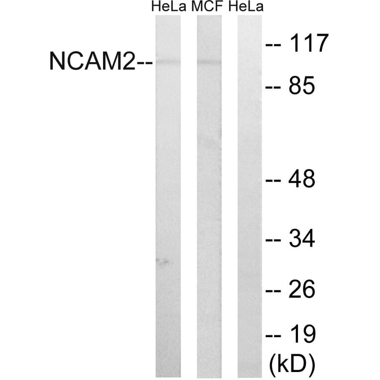 Western Blot - Anti-NCAM2 Antibody (C16899) - Antibodies.com