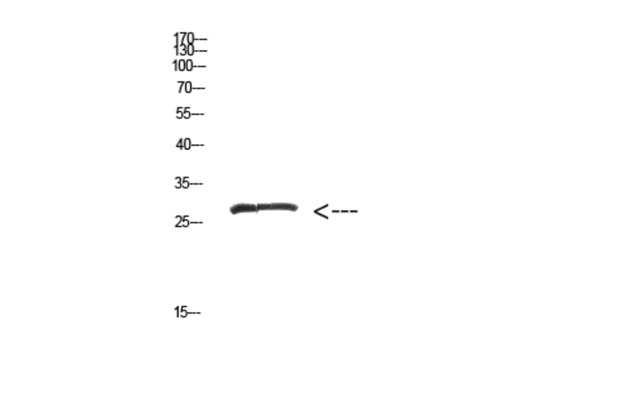 Western Blot - Anti-MYOZ2 Antibody (C31013) - Antibodies.com