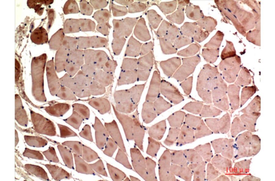 Immunohistochemistry - Anti-MYOD1 Antibody (C30039) - Antibodies.com