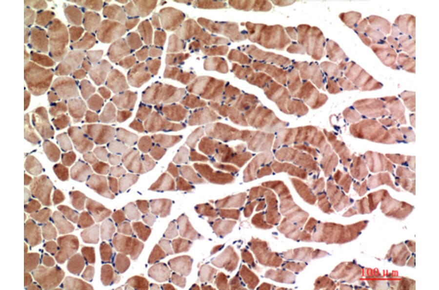 Immunohistochemistry - Anti-MYOD1 Antibody (C30039) - Antibodies.com