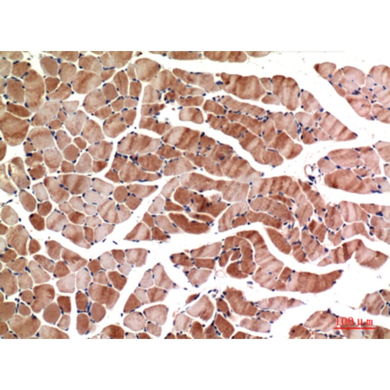 Immunohistochemistry - Anti-MYOD1 Antibody (C30039) - Antibodies.com