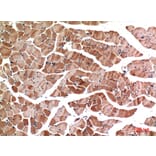 Immunohistochemistry - Anti-MYOD1 Antibody (C30039) - Antibodies.com