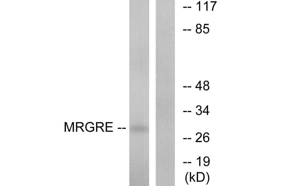 Western Blot - Anti-MRGRE Antibody (G391) - Antibodies.com