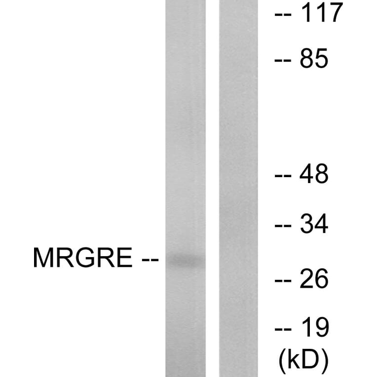 Western Blot - Anti-MRGRE Antibody (G391) - Antibodies.com