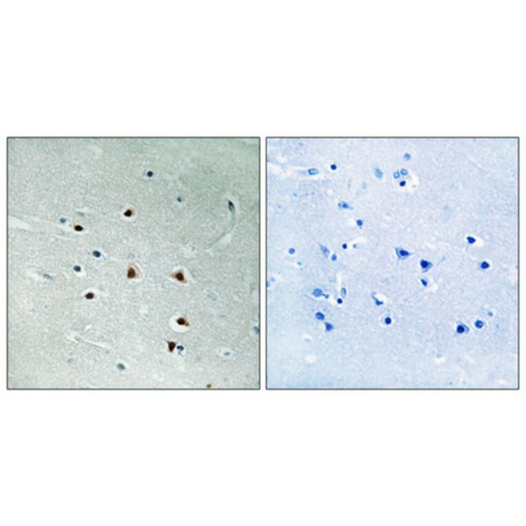 Immunohistochemistry - Anti-MRE11 Antibody (B1217) - Antibodies.com